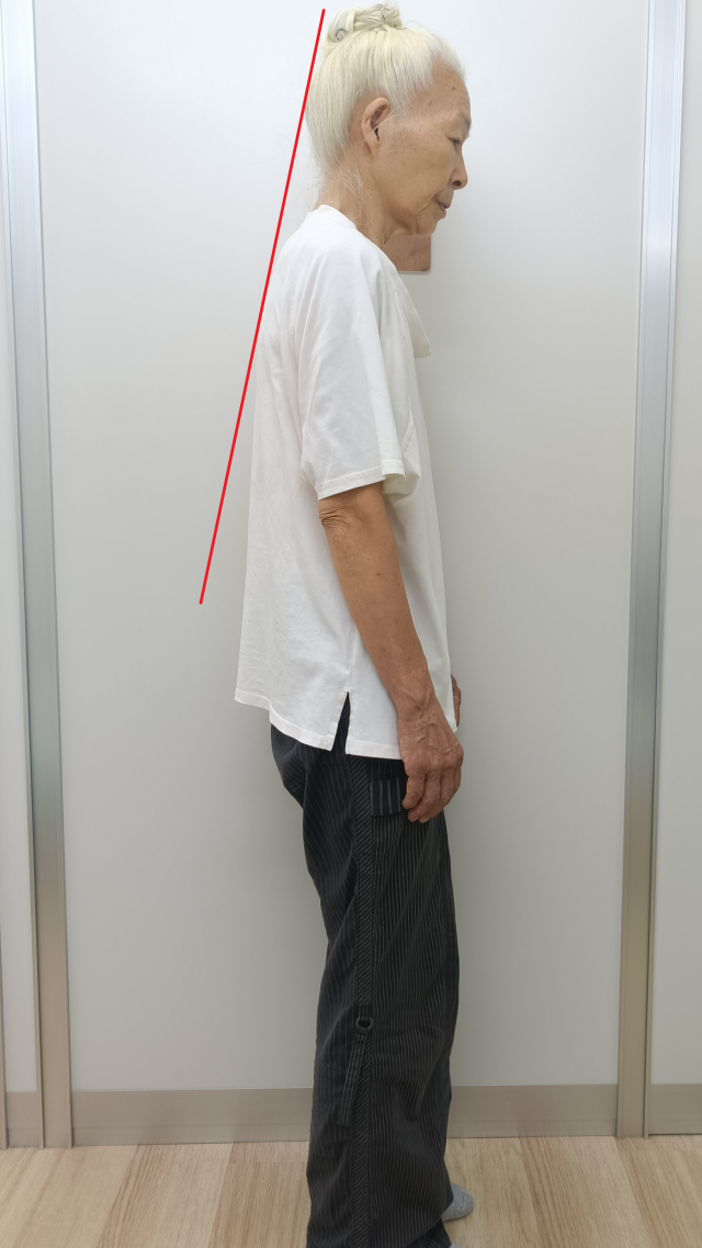 before画像