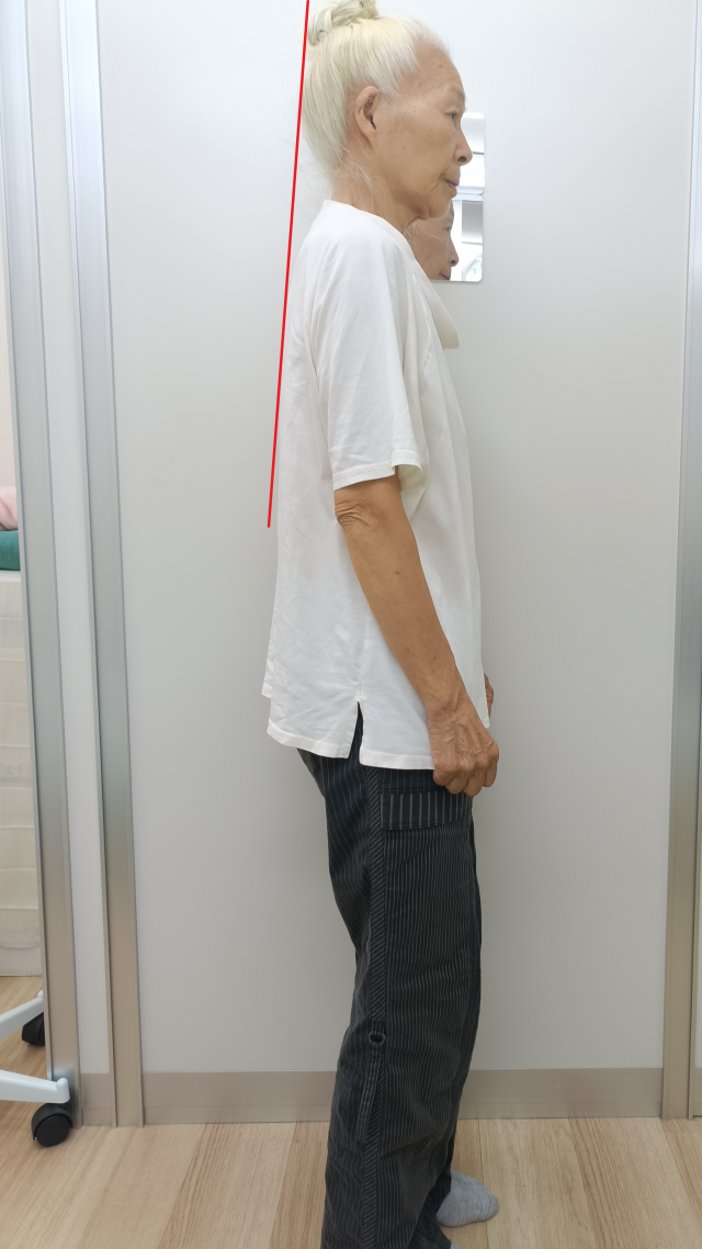 after画像