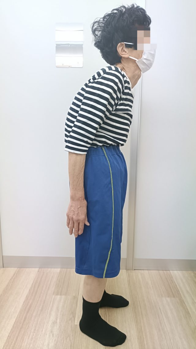 before画像